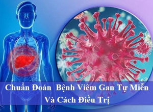 Chuẩn Đoán  Bệnh Viêm Gan Tự Miễn Và Cách Điều Trị